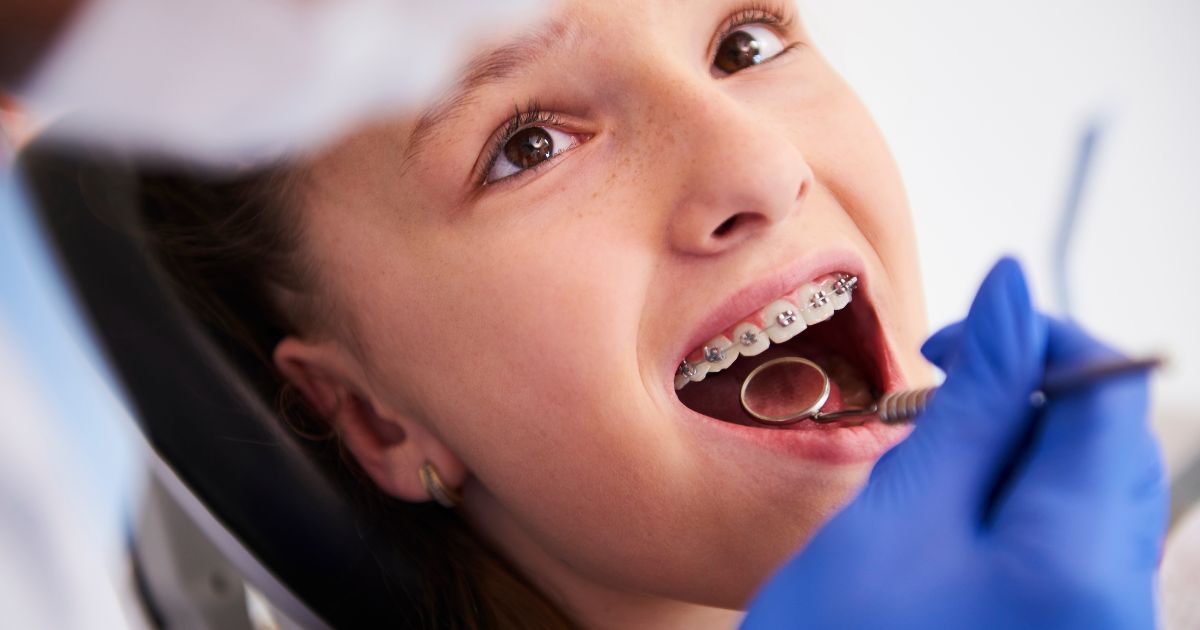 Parent'S Guide To Braces For Kids Who Live In Hiram And Acworth, Ga